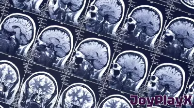 More time spent playing video games is linked to a thinner cerebral cortex in adolescents